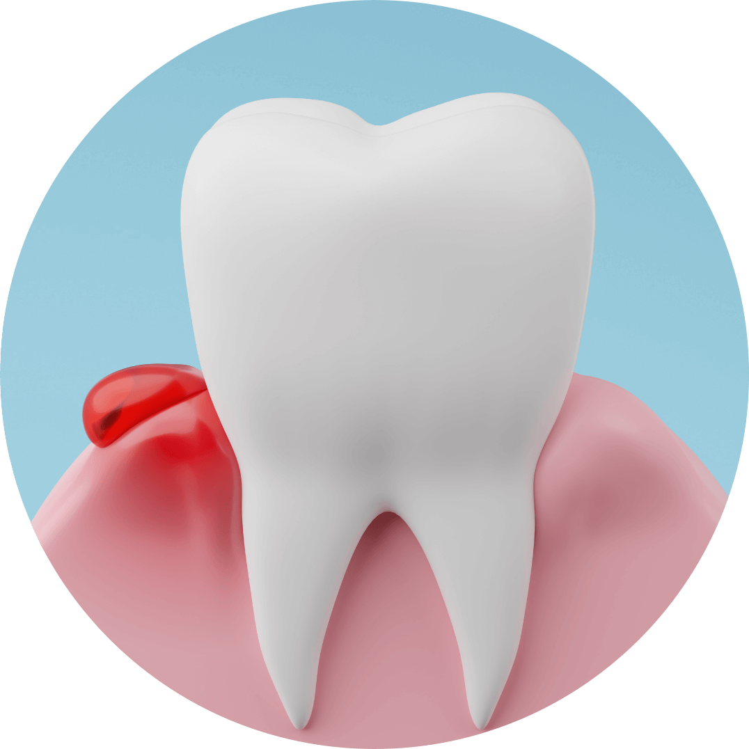 高円寺駅南口徒歩2分の歯医者、高円寺PAL歯科医院の歯周病治療