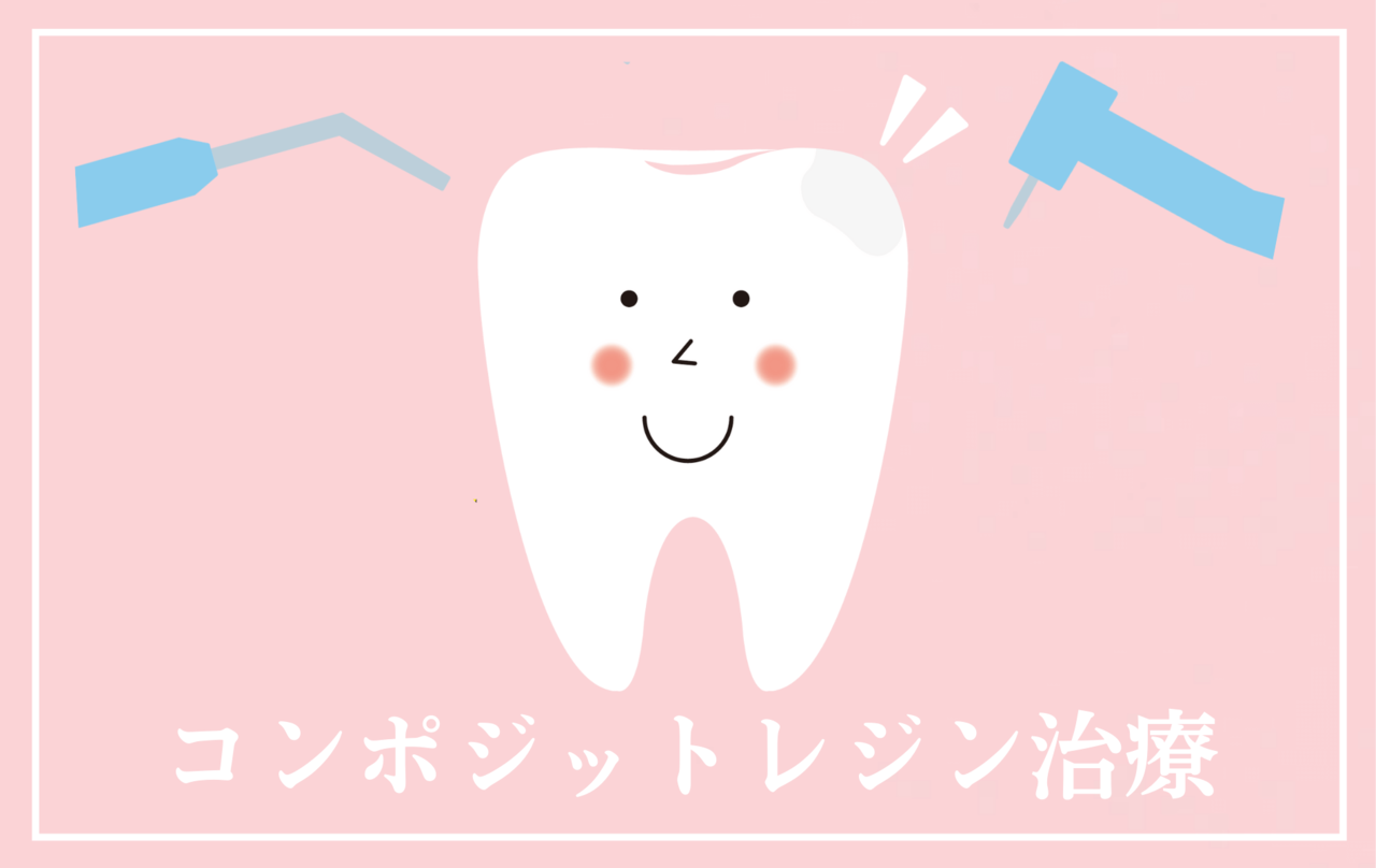 高円寺駅南口徒歩2分の歯医者、高円寺PAL歯科医院のコンポジットレジン治療