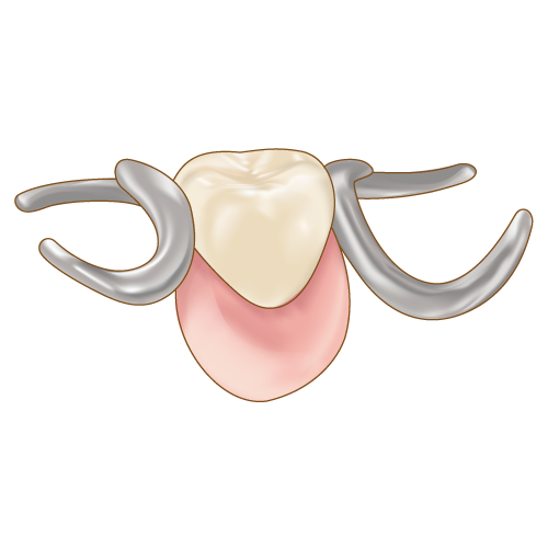 高円寺駅南口徒歩2分の歯医者、高円寺PAL歯科医院の入れ歯治療
