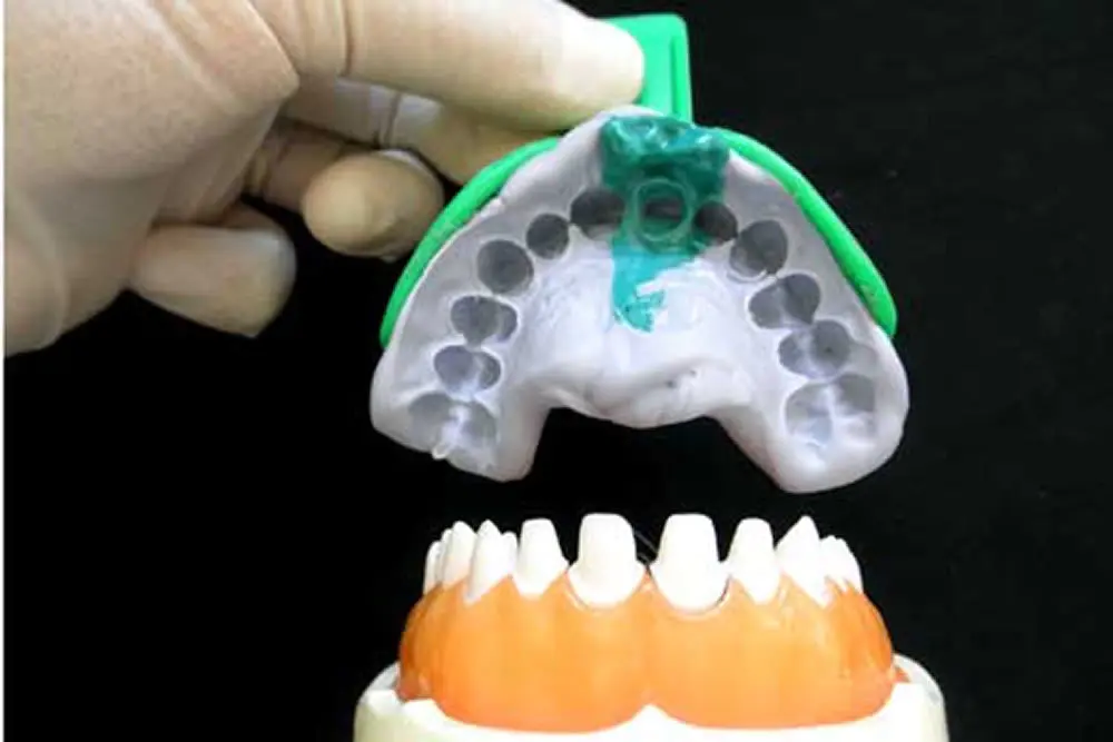 高円寺駅南口徒歩2分の歯医者、高円寺PAL歯科医院の歯を残す治療