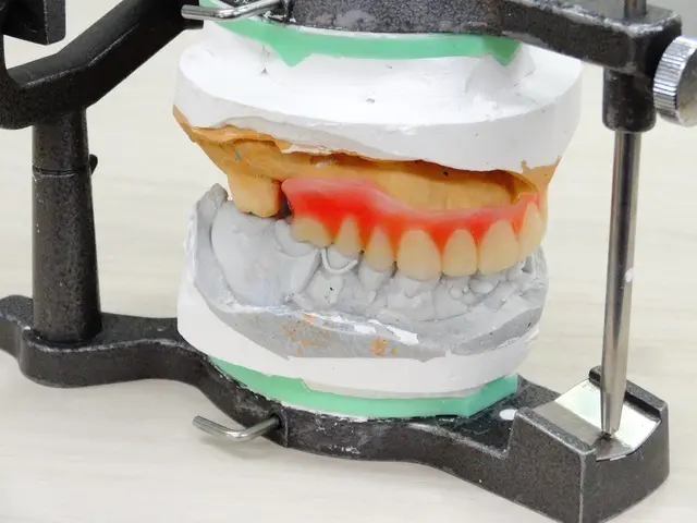 高円寺駅南口徒歩2分の歯医者、高円寺PAL歯科医院のインプラント治療の流れ