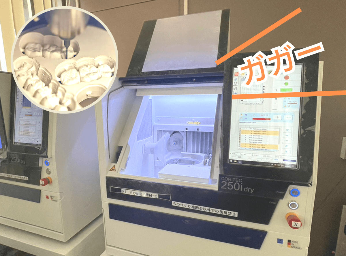 高円寺駅南口徒歩2分の歯医者、高円寺PAL歯科医院のセラミック治療の流れ