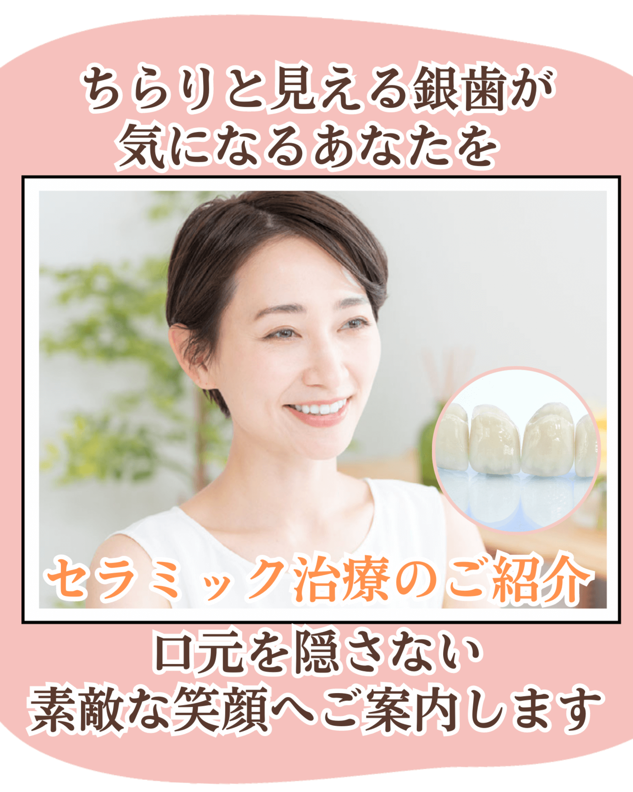 高円寺駅南口徒歩2分の歯医者、高円寺PAL歯科医院のセラミック治療