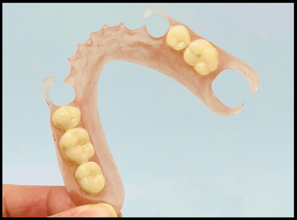 高円寺駅南口徒歩2分の歯医者、高円寺PAL歯科医院の入れ歯治療