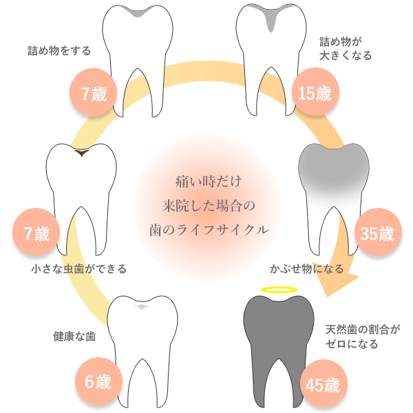 高円寺駅南口徒歩2分の歯医者、高円寺PAL歯科医院の治療後のメンテナンス