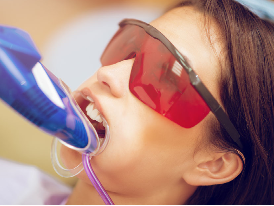 高円寺駅南口徒歩2分の歯医者、高円寺PAL歯科医院のホワイトニング