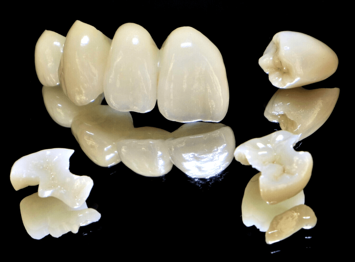 高円寺駅南口徒歩2分の歯医者、高円寺PAL歯科医院の歯周病・短期集中治療