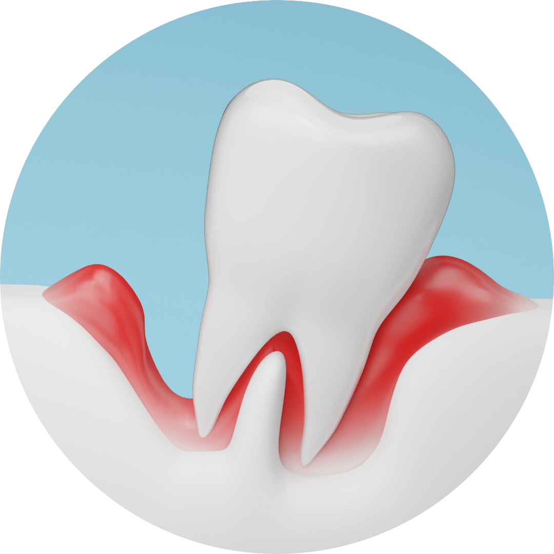 高円寺駅南口徒歩2分の歯医者、高円寺PAL歯科医院の歯周病治療