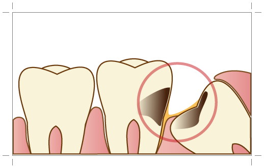 高円寺駅南口徒歩2分の歯医者、高円寺PAL歯科医院の口腔外科