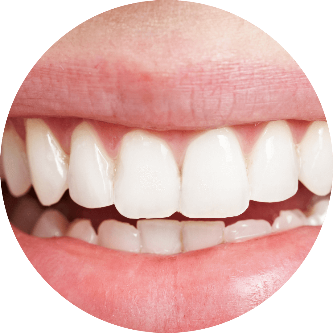 高円寺駅南口徒歩2分の歯医者、高円寺PAL歯科医院のむし歯治療