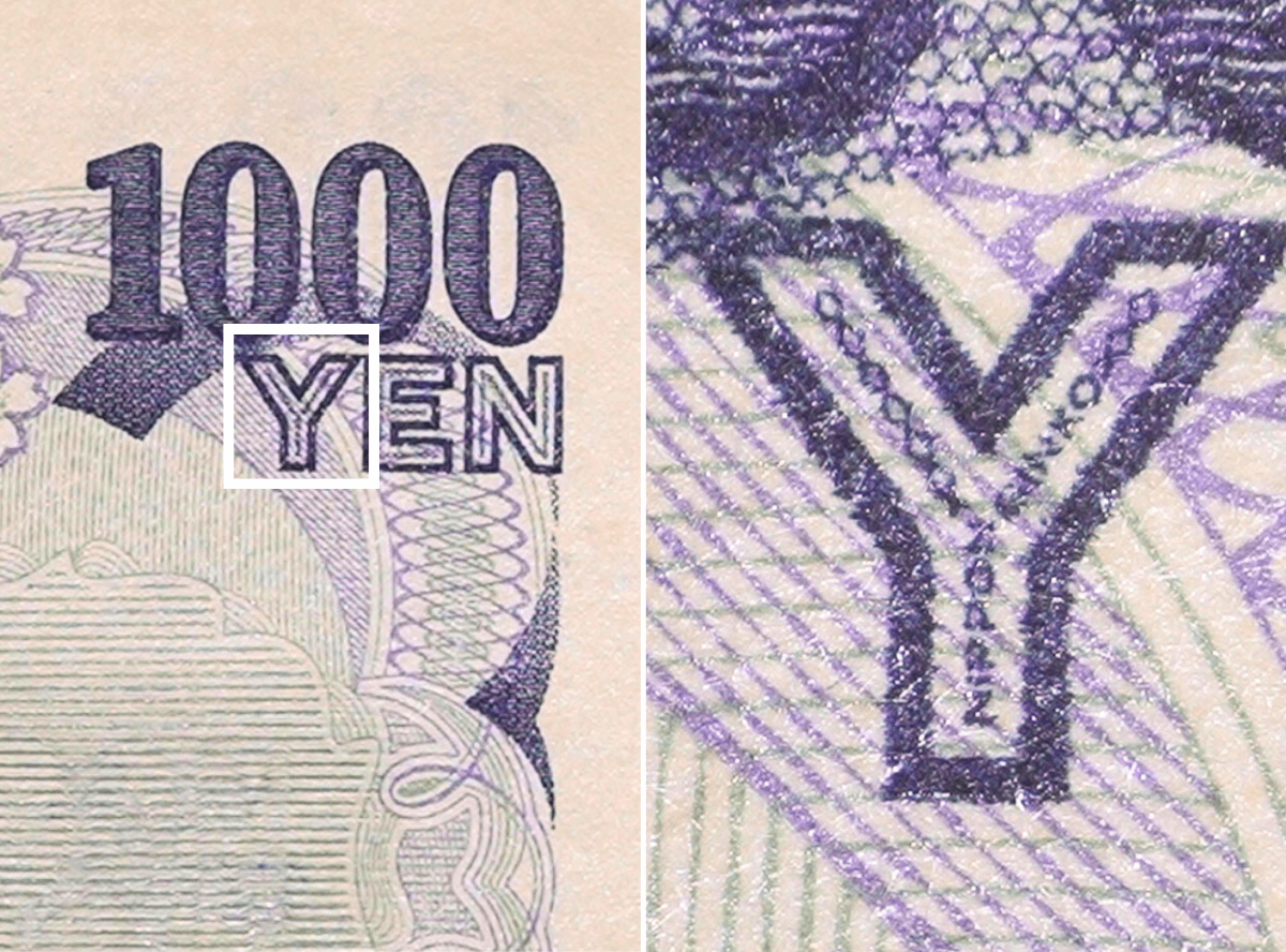 高円寺駅南口徒歩2分の歯医者、高円寺PAL歯科医院のマイクロスコープ診療