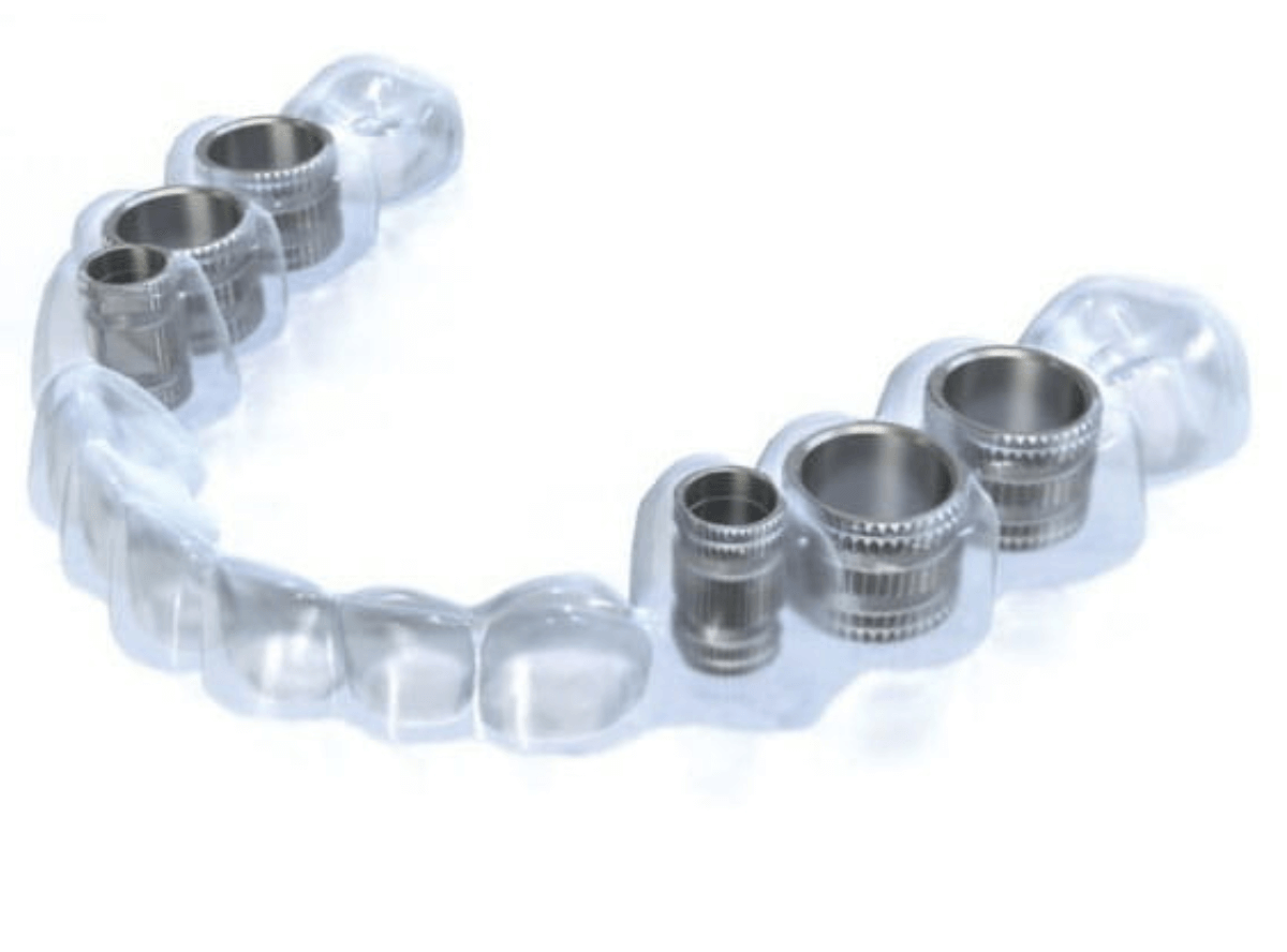 高円寺駅南口徒歩2分の歯医者、高円寺PAL歯科医院の模型による診断