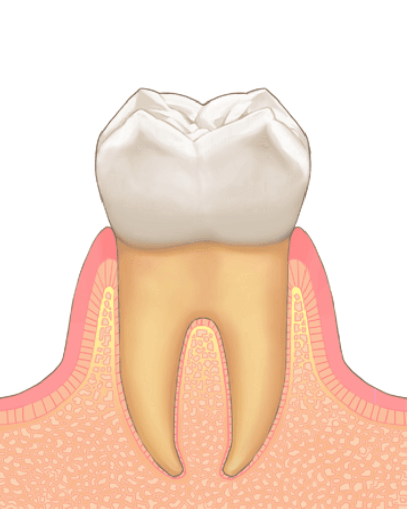 高円寺駅南口徒歩2分の歯医者、高円寺PAL歯科医院の歯周病治療