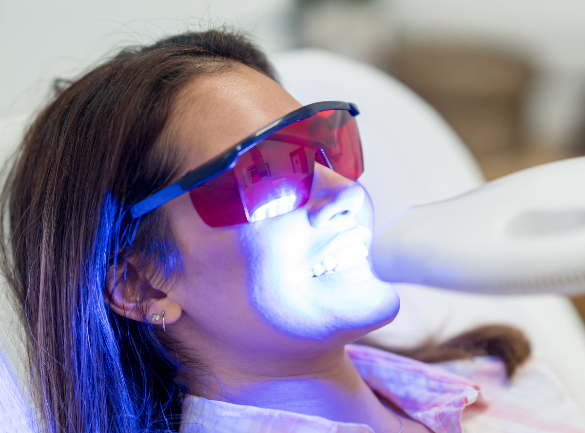 高円寺駅南口徒歩2分の歯医者、高円寺PAL歯科医院のホワイトニング