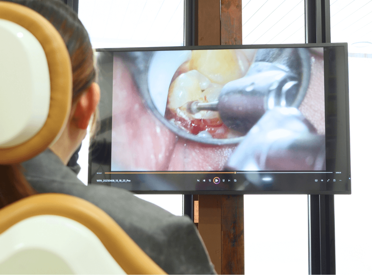 高円寺駅南口徒歩2分の歯医者、高円寺PAL歯科医院のマイクロスコープ診療