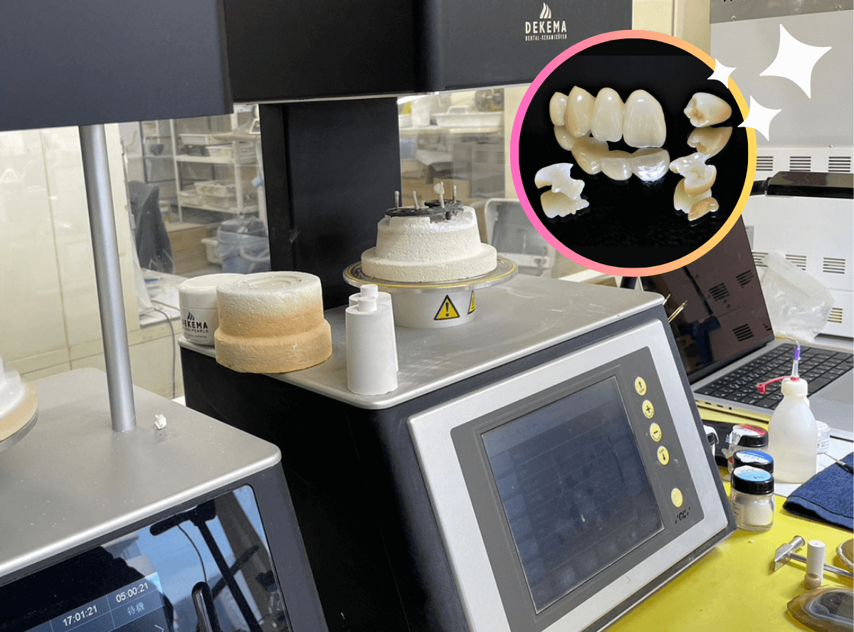 高円寺駅南口徒歩2分の歯医者、高円寺PAL歯科医院のセラミック治療の流れ