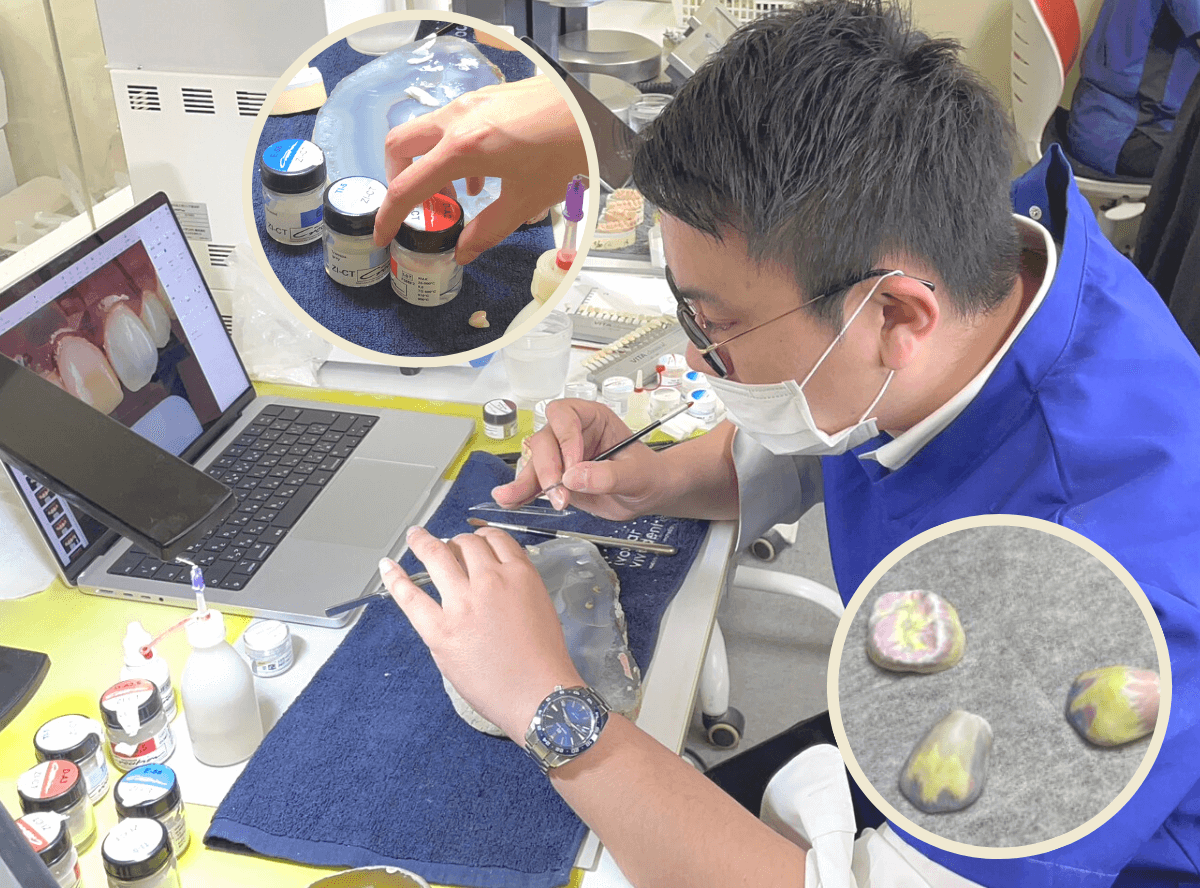 高円寺駅南口徒歩2分の歯医者、高円寺PAL歯科医院のセラミック治療の流れ