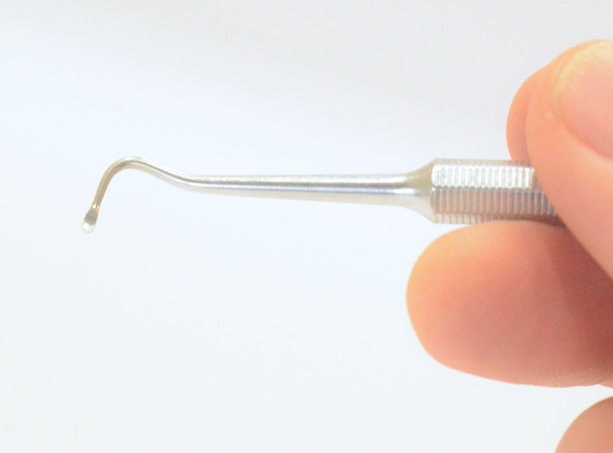 高円寺駅南口徒歩2分の歯医者、高円寺PAL歯科医院の歯を残す治療