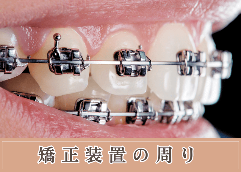 高円寺駅南口徒歩2分の歯医者、高円寺PAL歯科医院のむし歯治療