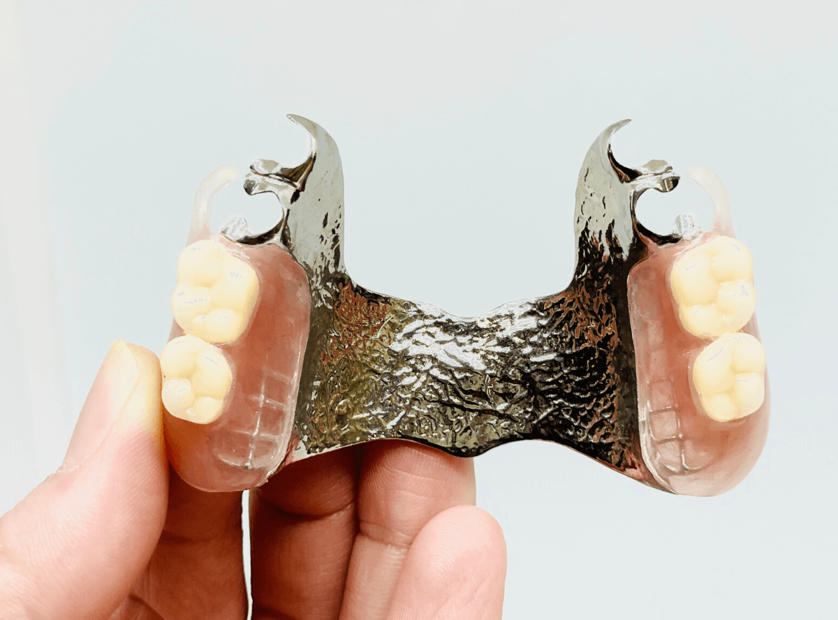 高円寺駅南口徒歩2分の歯医者、高円寺PAL歯科医院の歯周病・短期集中治療