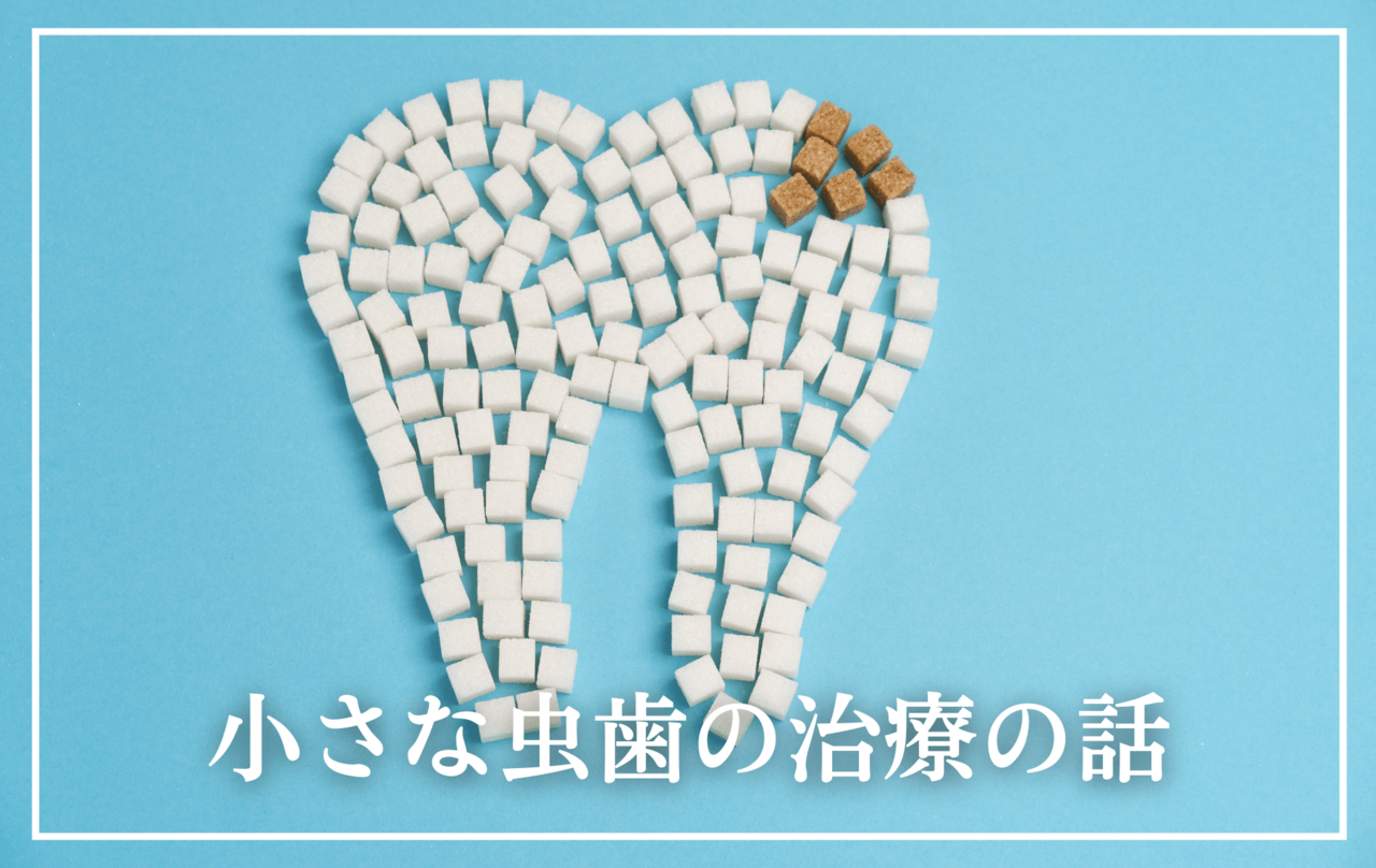 高円寺駅南口徒歩2分の歯医者、高円寺PAL歯科医院の小さな虫歯の治療の話