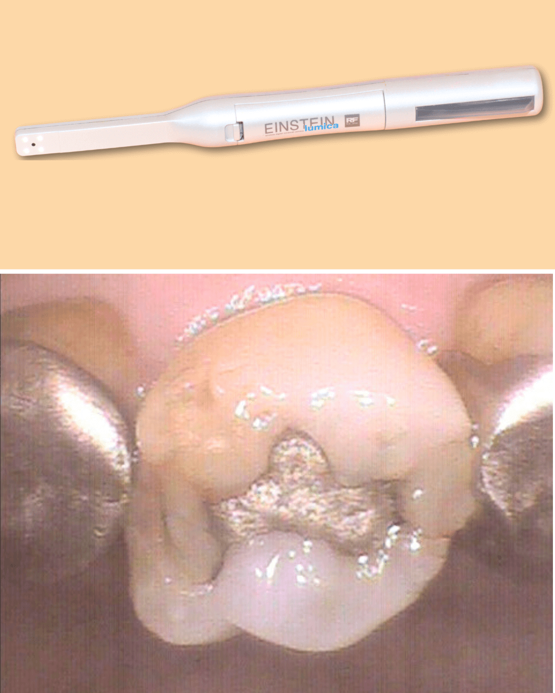 高円寺駅南口徒歩2分の歯医者、高円寺PAL歯科医院の歯を残す治療