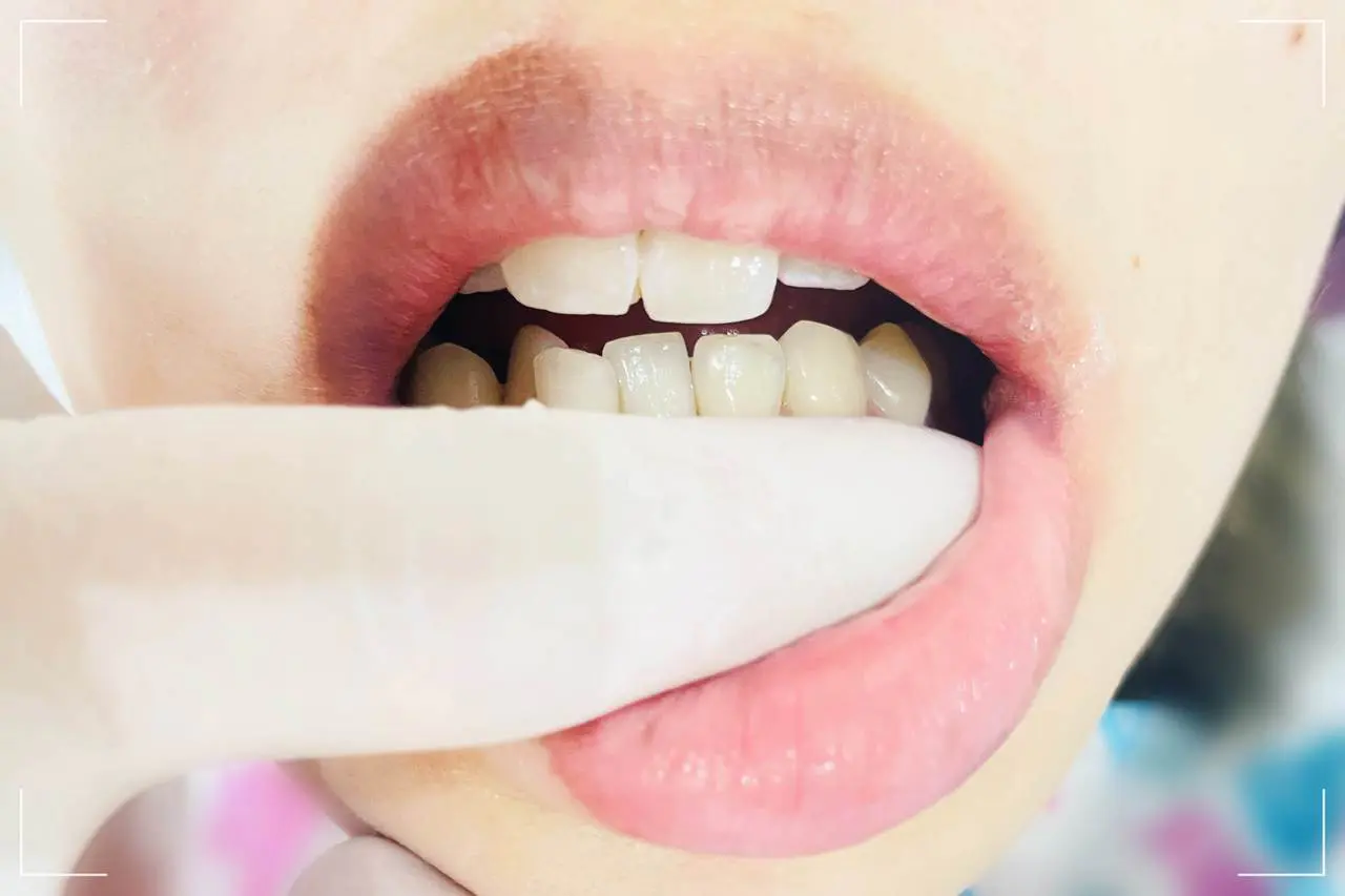 高円寺駅南口徒歩2分の歯医者、高円寺PAL歯科医院の歯科衛生士さんの募集要項