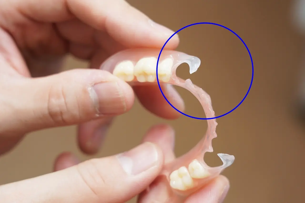 高円寺駅南口徒歩2分の歯医者、高円寺PAL歯科医院の入れ歯治療