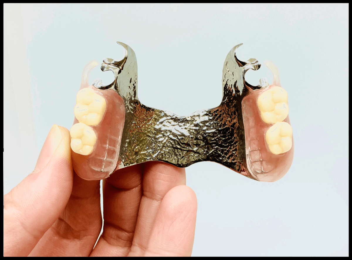 高円寺駅南口徒歩2分の歯医者、高円寺PAL歯科医院の入れ歯治療