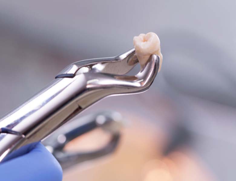 高円寺駅南口徒歩2分の歯医者、高円寺PAL歯科医院の口腔外科