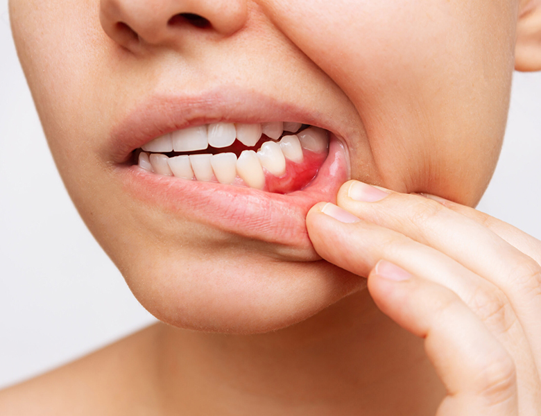 高円寺駅南口徒歩2分の歯医者、高円寺PAL歯科医院の歯周病治療