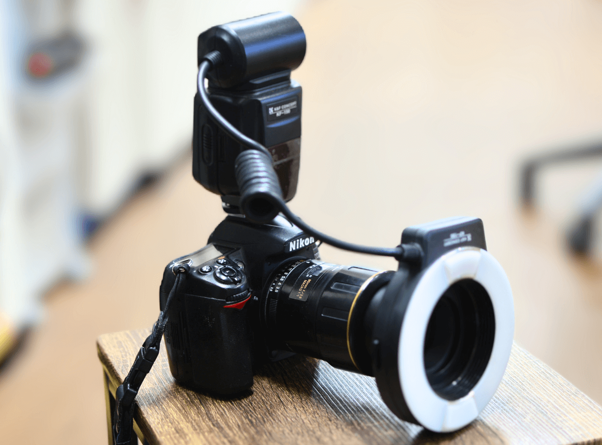 高円寺駅南口徒歩2分の歯医者、高円寺PAL歯科医院のむし歯治療