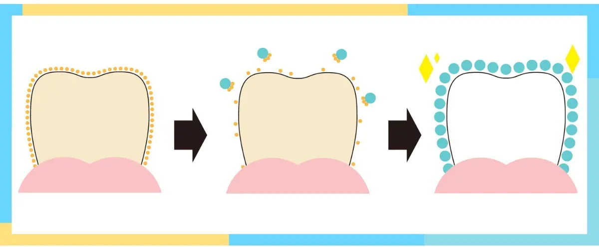 高円寺駅南口徒歩2分の歯医者、高円寺PAL歯科医院のホワイトニング治療