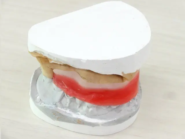 高円寺駅南口徒歩2分の歯医者、高円寺PAL歯科医院のインプラント治療の流れ