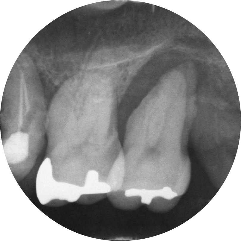 高円寺駅南口徒歩2分の歯医者、高円寺PAL歯科医院の歯周病治療