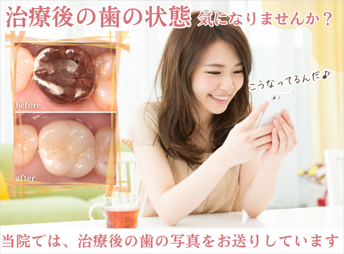 高円寺駅南口徒歩2分の歯医者、高円寺PAL歯科医院のセラミック治療