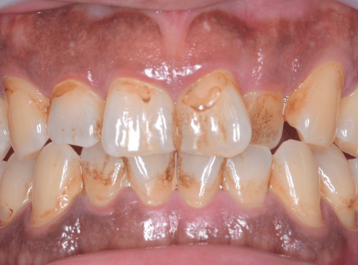 ビューティー・クリーニング(画像)-1