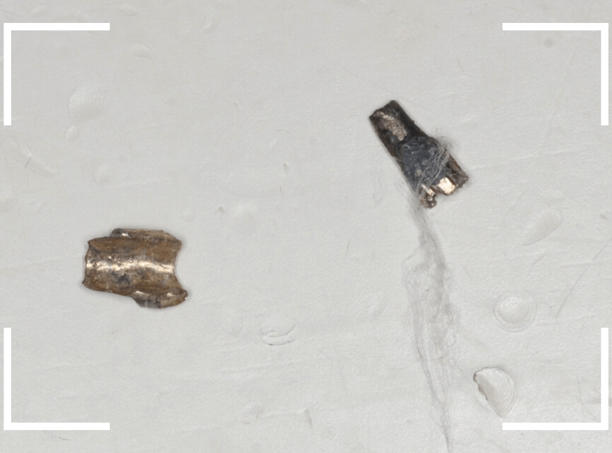 セラミック治療(前歯・クラウン)3-5