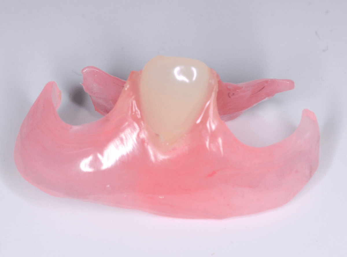 ノンクラスプ・デンチャー画像-4