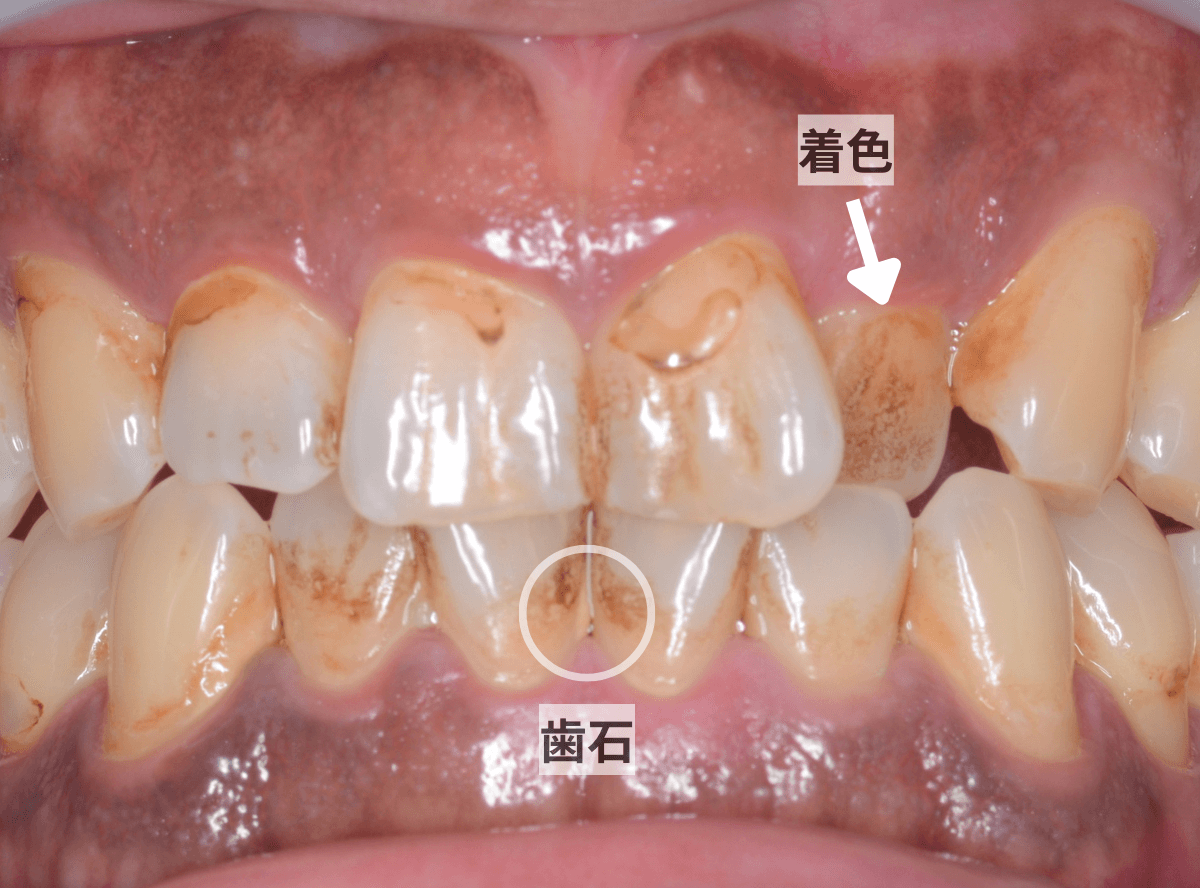 ビューティー・クリーニング(画像)-2