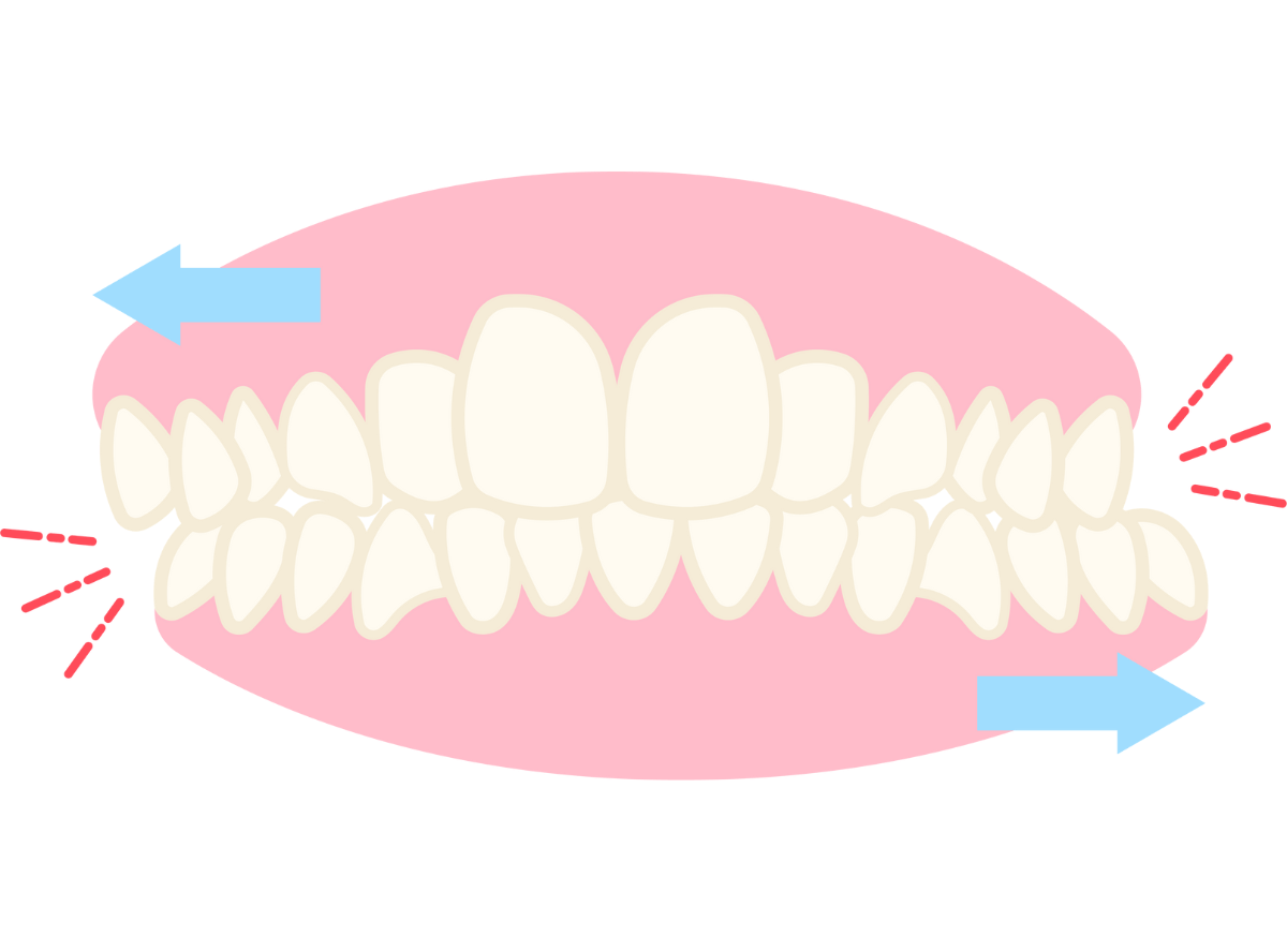 グラインディング