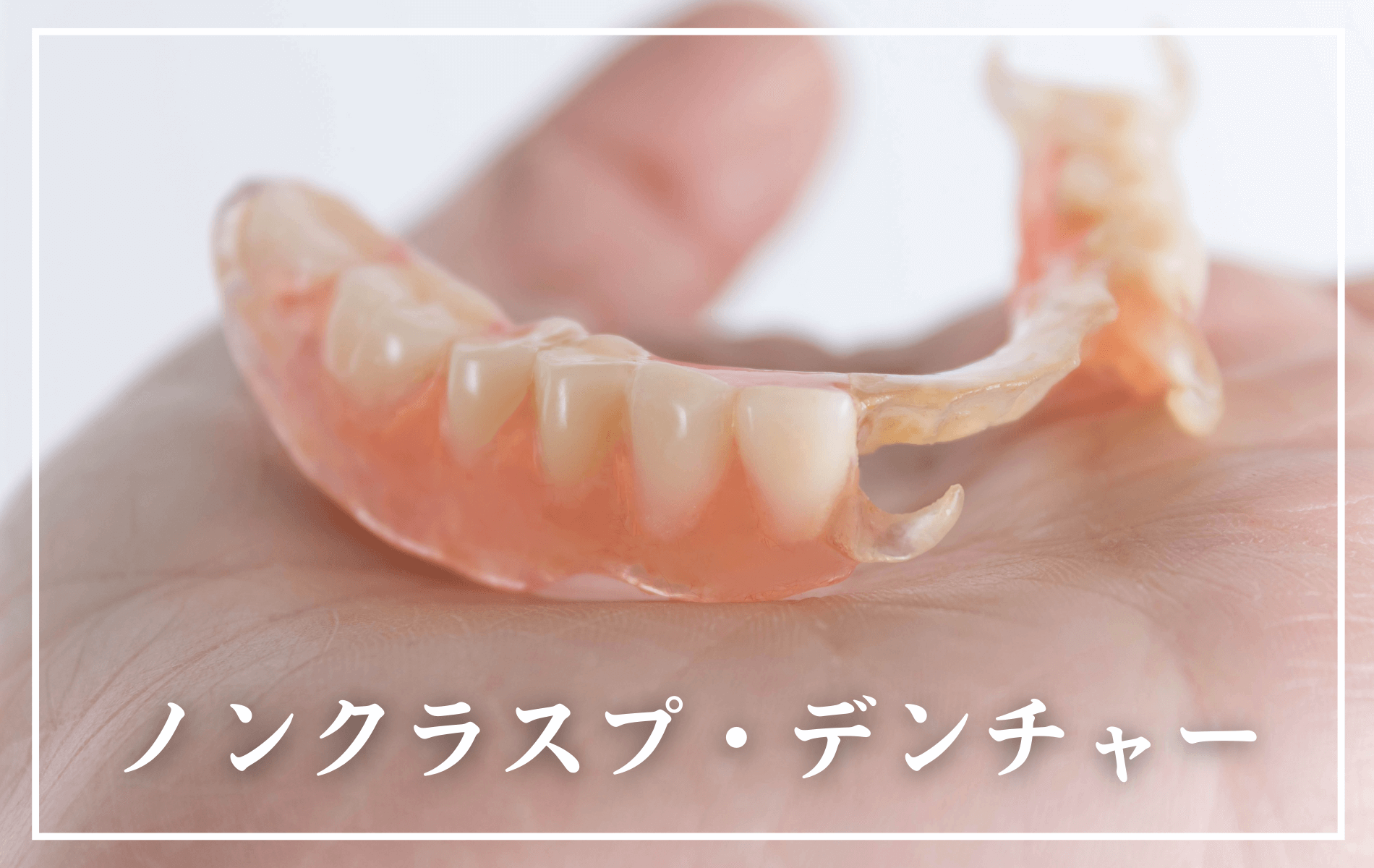 ノンクラスプ・デンチャー-タイトル