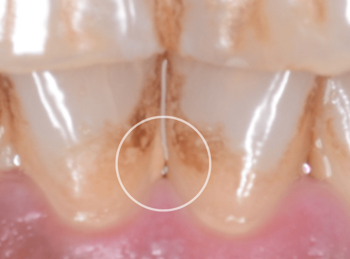 ビューティー・クリーニング(画像)-3