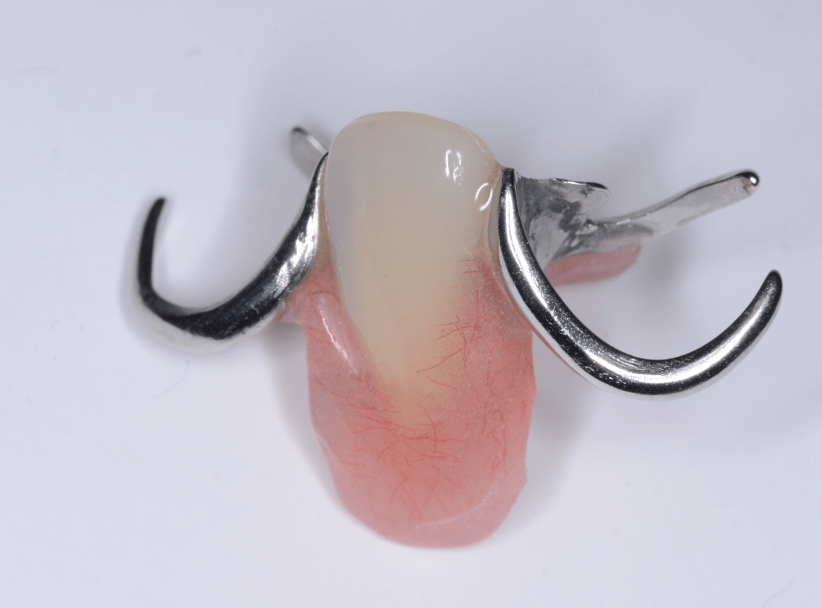 ノンクラスプ・デンチャー画像-2