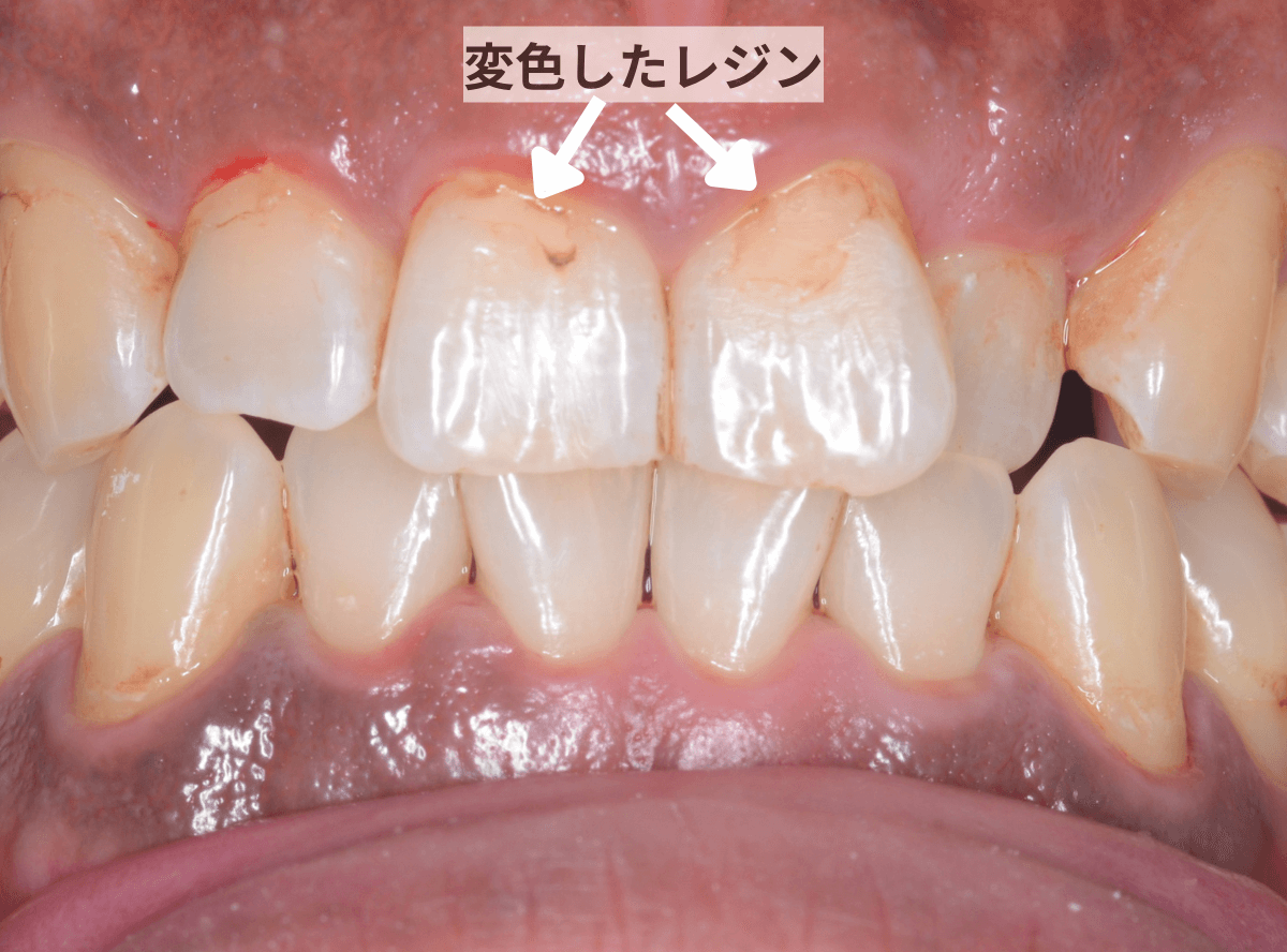 ビューティー・クリーニング(画像)-4