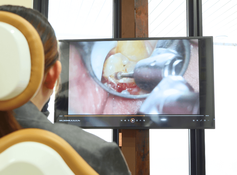 高円寺駅南口徒歩2分の歯医者、高円寺PAL歯科医院の歯を残す治療