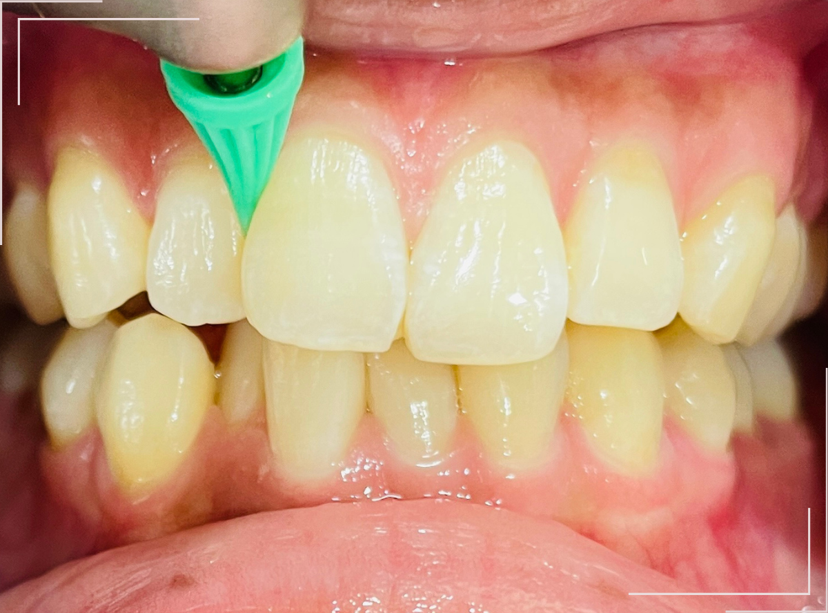 高円寺駅南口徒歩2分の歯医者、高円寺PAL歯科医院の歯科衛生士さんの募集要項