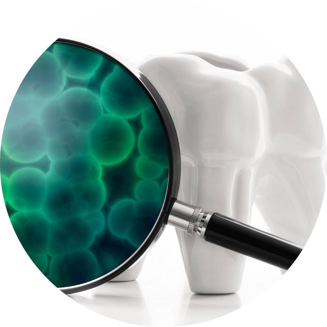 高円寺駅南口徒歩2分の歯医者、高円寺PAL歯科医院のむし歯治療