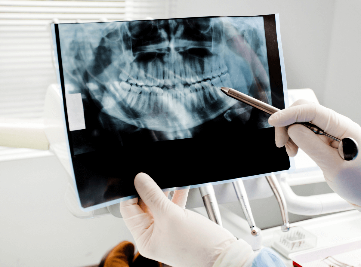 高円寺駅南口徒歩2分の歯医者、高円寺PAL歯科医院の口腔外科