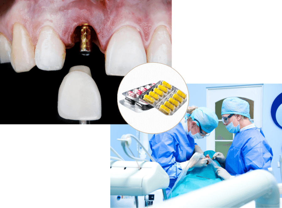 高円寺駅南口徒歩2分の歯医者、高円寺PAL歯科医院のインプラント治療の費用